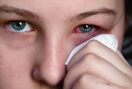 Cách chữa trị kịp thời bệnh đau mắt đỏ